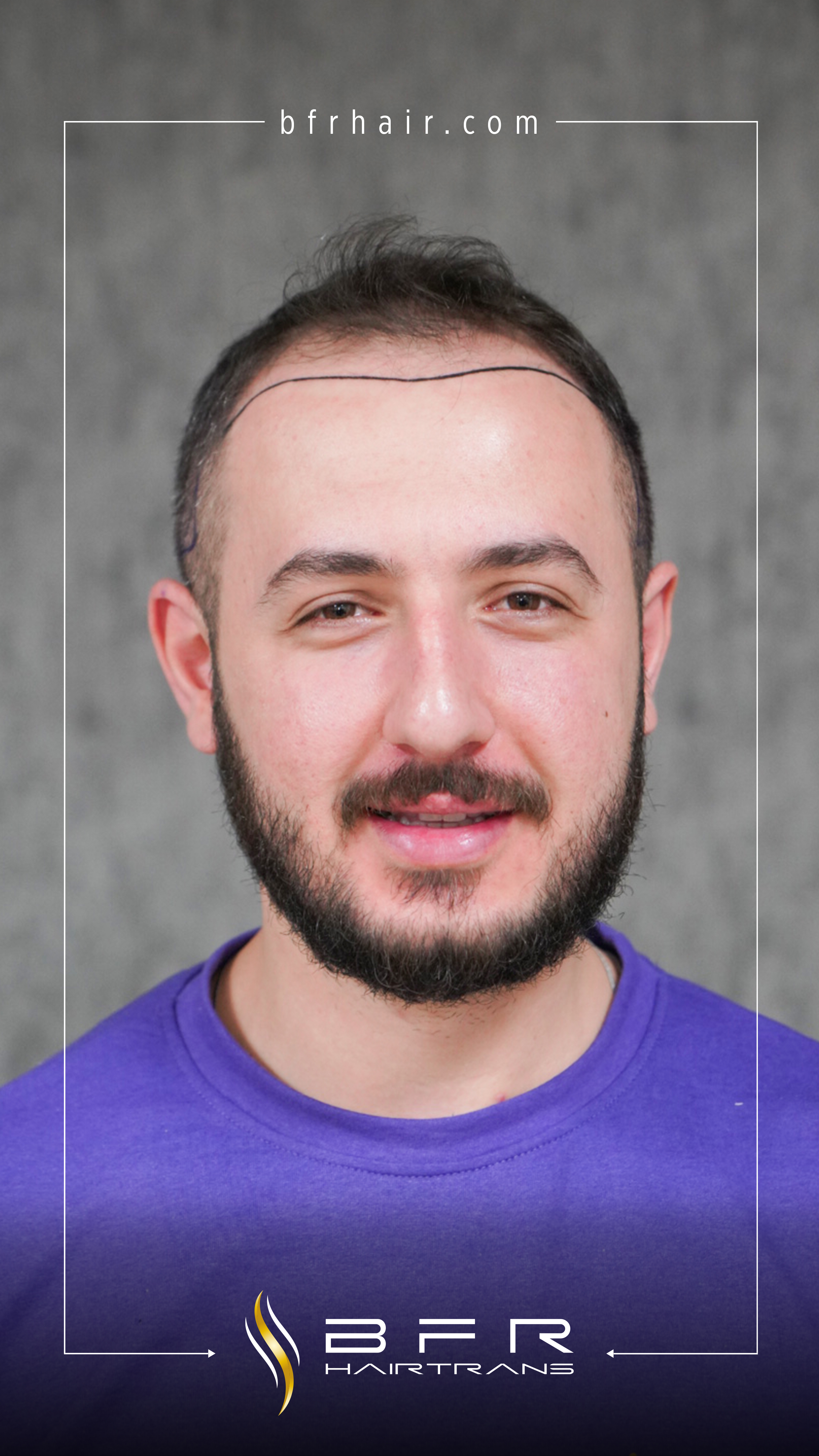 neden biz için 3
